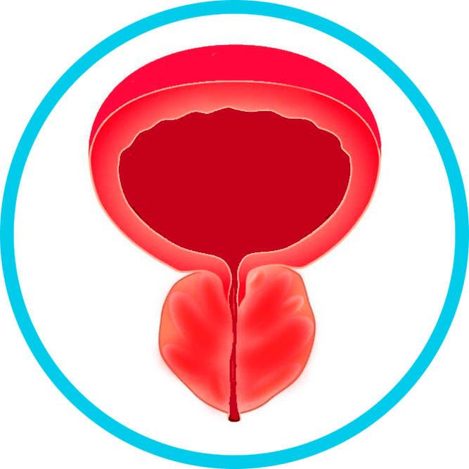 Prostatiidi sümptomid